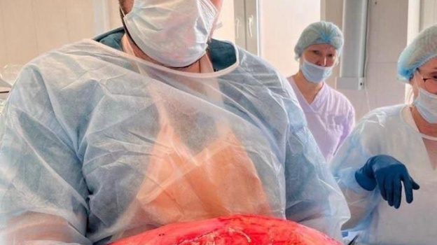 20-киллограмовую опухоль извлекли хирурги из пациента во время операции в Севастополе