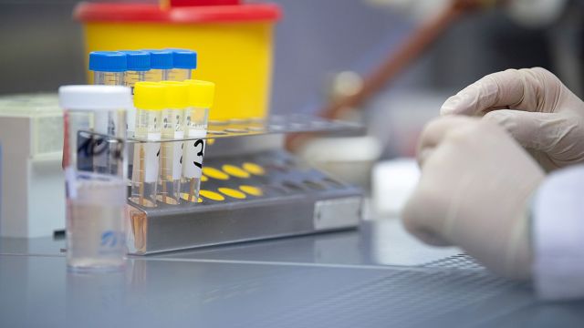 Стало известно в каких городах Крыма зафиксированы случаи коронавируса