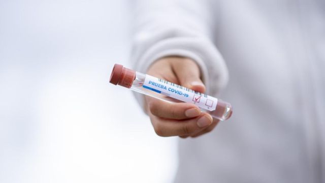 В Севастополе 12 человек заболели COVID-19 за сутки