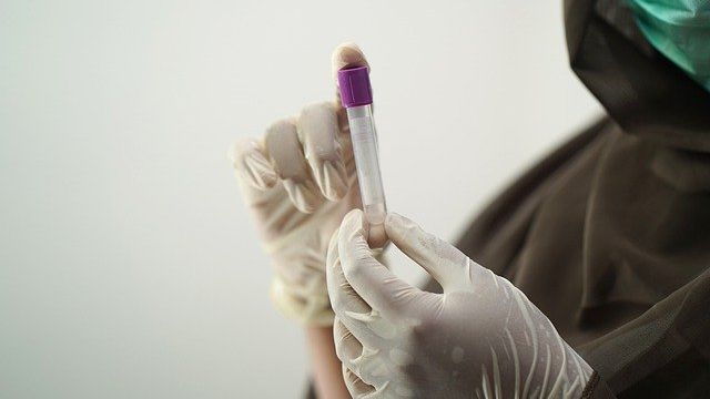 В Севастополе 30 новых случаев COVID-19