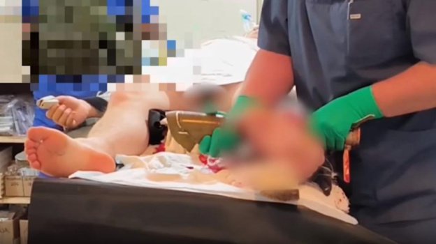 Хирурги извлекли из тела российского военного неразорвавшийся снаряд от ручного гранатомета