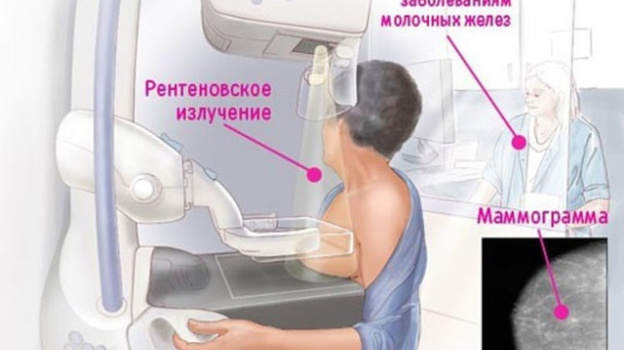 В Ялте и поселках южного берега Крыма продолжит работу выездной маммограф